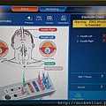 甲狀腺手術聲帶返喉神經監測電腦 IONM