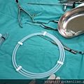 內視鏡耳咽管氣球擴張術 endoscopic E tube balloon tuboplasty