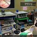 耳咽管阻塞 簡易的耳咽管氣球擴張術 E tube balloon tuboplasty