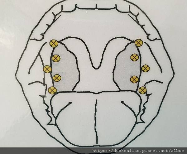 打鼾 打呼 睡眠呼吸中止症 劉耿僚醫師 snoring OSAS