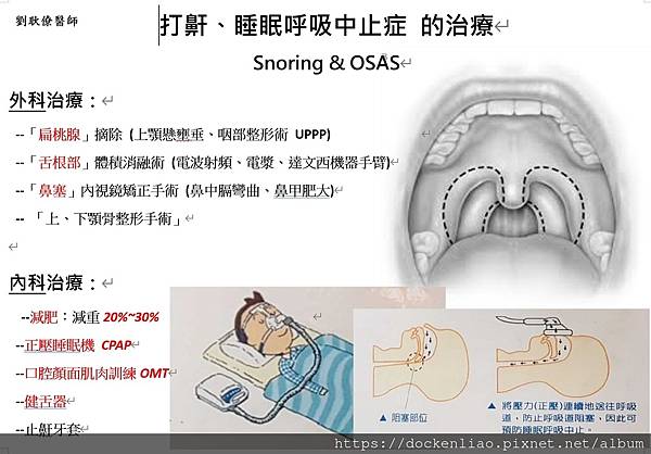 snoring osas 打鼾打呼睡眠呼吸中止症 衛教單 