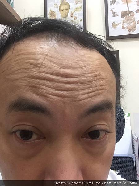 照片 132 照片 132