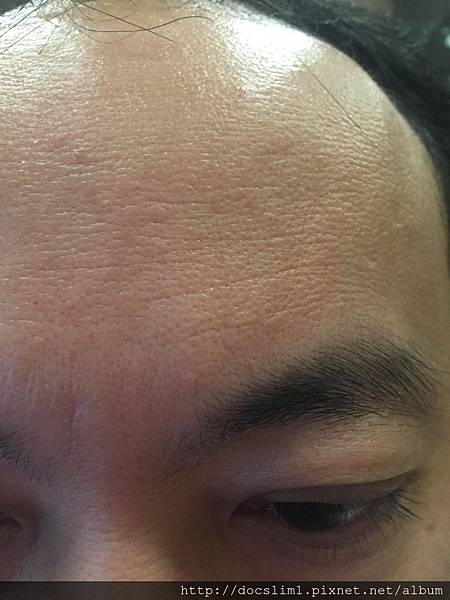 照片 122 照片 122