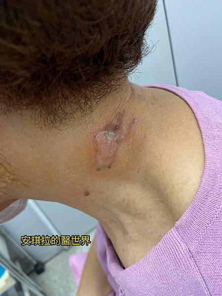 隱翅蟲.JPG 隱翅蟲.JPG