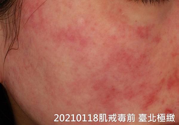 20210316 (4).jpg 20210316 (4).jpg