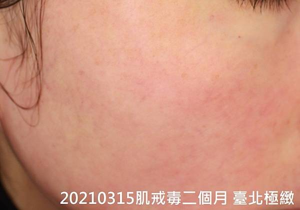 20210316 (5).jpg 20210316 (5).jpg