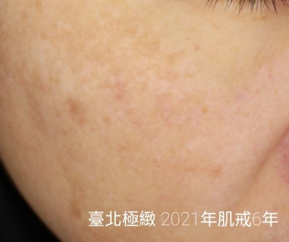 20210316 (7).jpg 20210316 (7).jpg