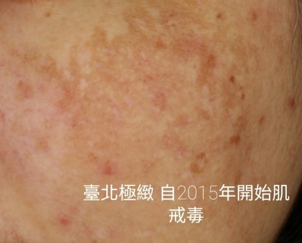 20210316 (8).jpg 20210316 (8).jpg