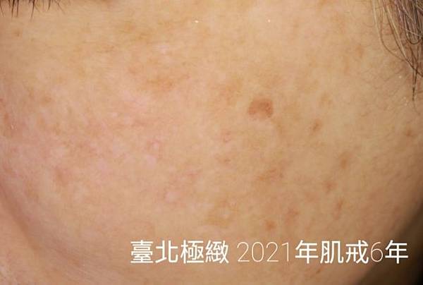 20210316 (9).jpg 20210316 (9).jpg