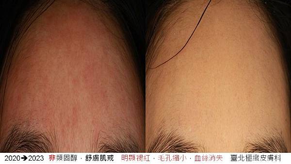 投影片1.JPG 投影片1.JPG