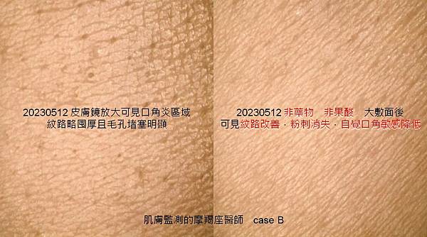 投影片2.JPG