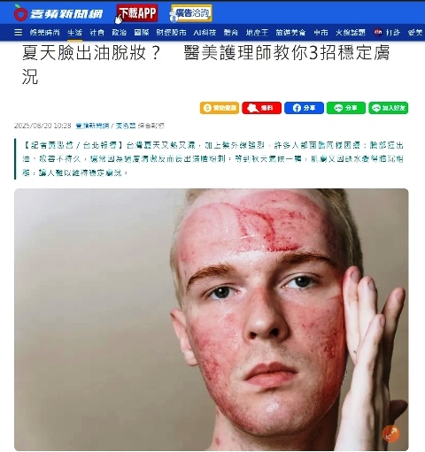 受訪文章》夏天臉出油脫妝？　醫美護理師教你3招穩定膚況
