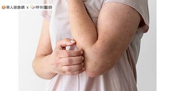 受訪文章》快看你的洗髮精！歐盟早禁1成分　很多人還在用，醫曝