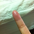 thumb