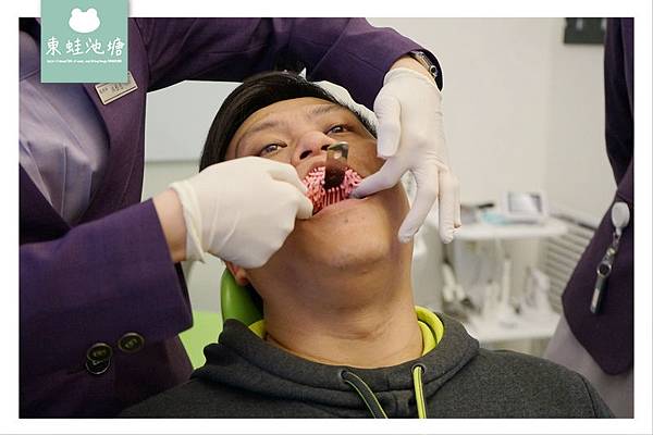 【新竹植牙推薦】人工植牙第二關：導引式植牙手術導引板 日光翡麗牙醫診所