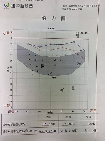 【台北助聽器推薦】免費聽力檢查 西門子西嘉助聽器 維膜助聽器忠孝門市