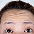 【麗波永康國際診所】PICOPLUS皮秒雷射 不讓歲月在臉上留下痕跡