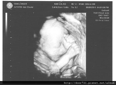 our_baby_22w_09.jpg