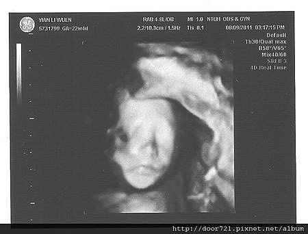 our_baby_22w_02.jpg