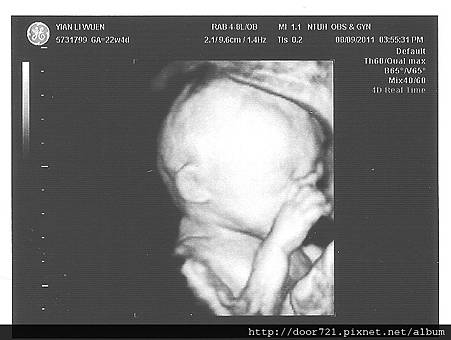 our_baby_22w_06.jpg