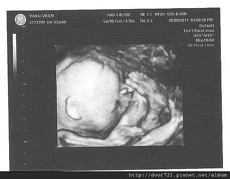 our_baby_22w_07.jpg