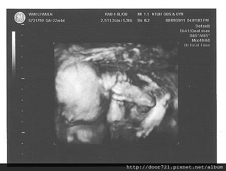 our_baby_22w_08.jpg