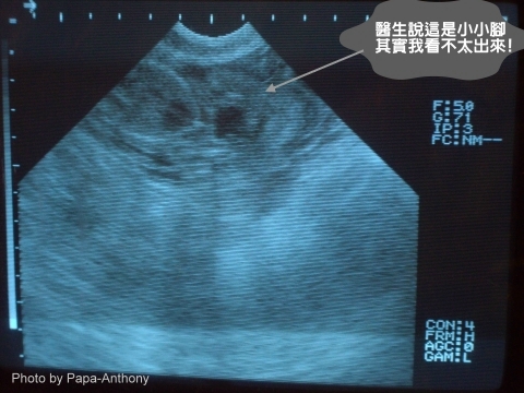 Nana生產日記 一 超音波 Dora S Daily Deli 痞客邦 Nana生產日記 一 超音波 Dora S Daily Deli 痞客邦