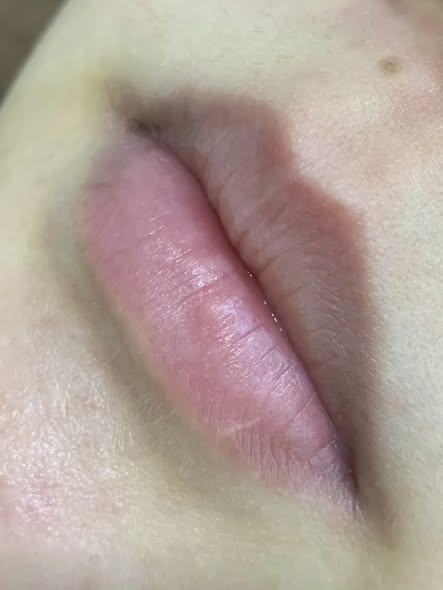 【台南霧唇】從裡到外徹底改善角質層後與暗的問題，還原乾淨唇色