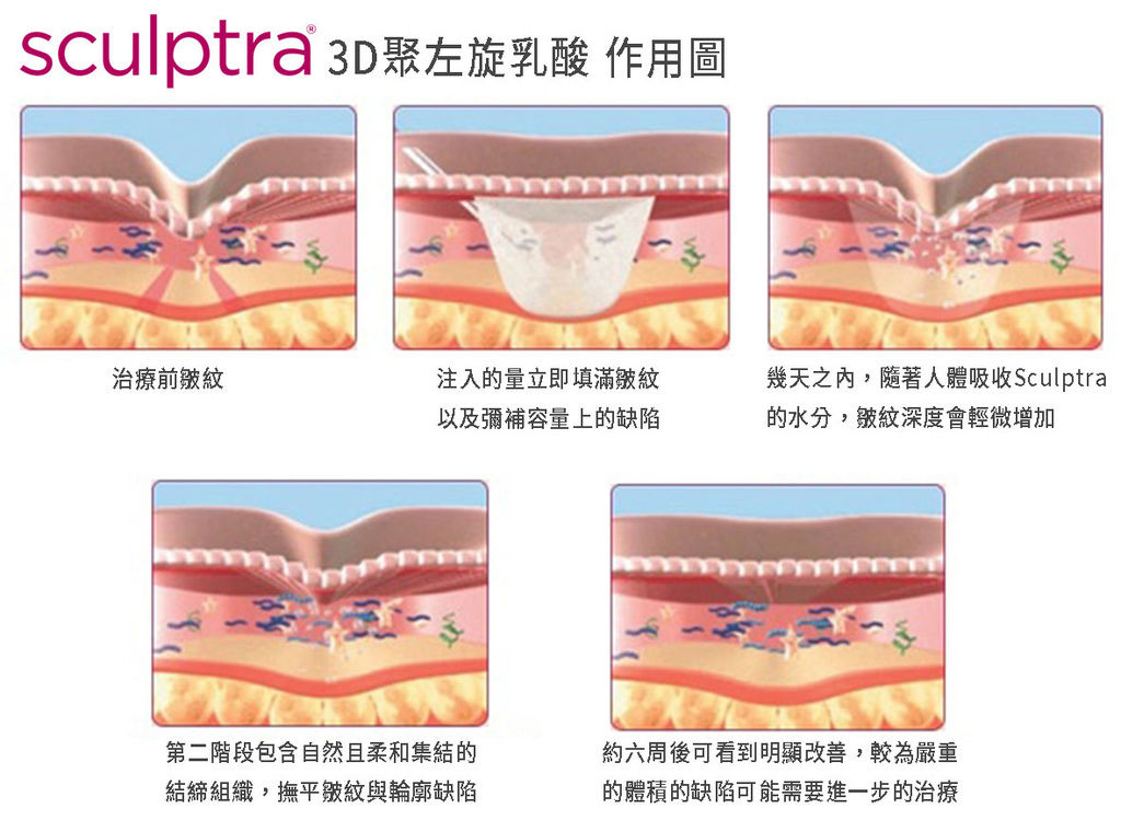 蘋果樹醫學診所蘋果樹醫美診所舒顏翠04.jpg