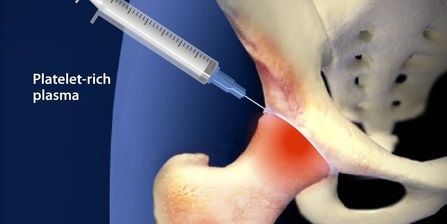 1397186030-1257936827_m