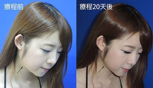 小之小臉針對比02