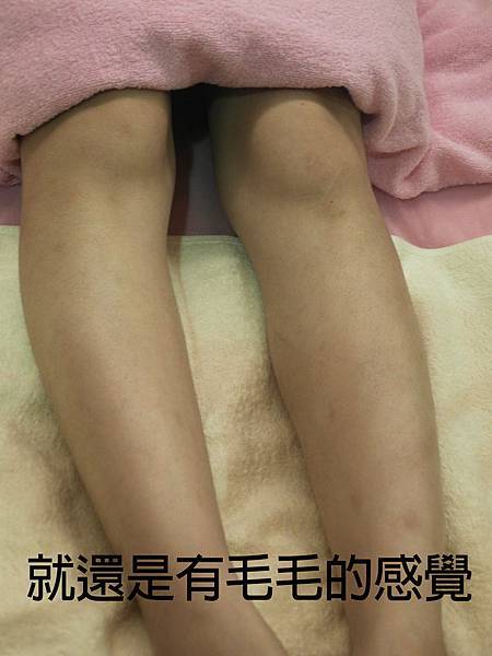 小腿除毛01