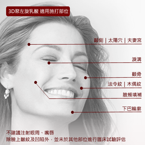 舒顏萃-聚左旋乳酸適用施打部位