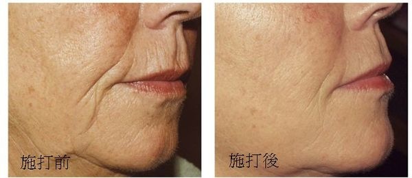 1393905664-2694978370_n