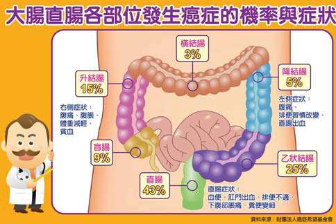 3成大腸癌患 腹痛就醫 已晚期