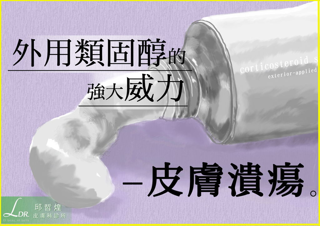 _外用類固醇的強大威力之一--皮膚潰瘍.jpg _外用類固醇的強大威力之一--皮膚潰瘍.jpg