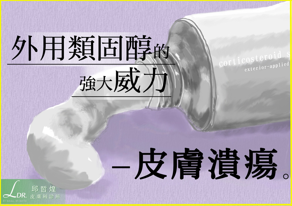 _外用類固醇的強大威力之一--皮膚潰瘍.jpg