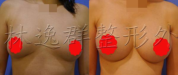 包心粉圓正面.jpg 包心粉圓正面.jpg