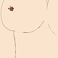 breast lesion.png