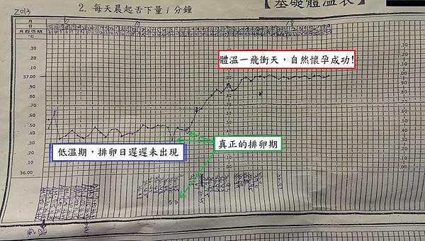 壓力型的多囊性卵巢症候群