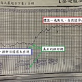 壓力型的多囊性卵巢症候群