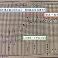 006H小姐的BBT圖.jpg