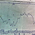 高溫期雖超過16天，但流產.jpg