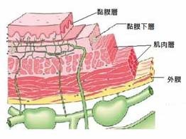 大腸癌 (三)