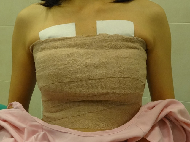 *网友分享~~自体脂肪隆乳之三温暖篇!