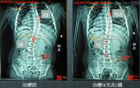 螢幕快照 2019-11-13 下午10.34.14.png