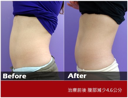 年後瘦小腹方法 年後瘦小腹方法
