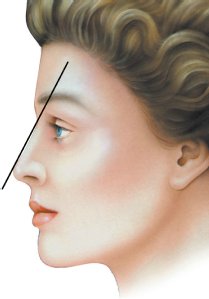 nose-18.jpg nose-18.jpg