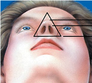 nose-16.jpg nose-16.jpg