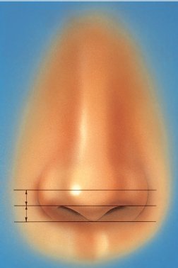 nose-11.jpg nose-11.jpg